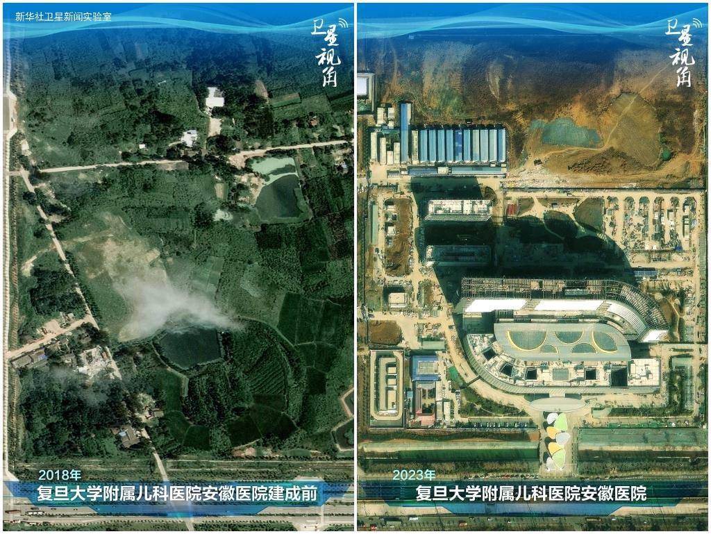 2023年與2018年相比，復(fù)旦大學(xué)附屬兒科醫(yī)院安徽醫(yī)院從一片荒地到建成投用。該項目是安徽省在長三角一體化高質(zhì)量發(fā)展衛(wèi)生健康領(lǐng)域的重大項目，也是安徽首批落地的國家區(qū)域醫(yī)療中心。
